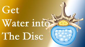 Satterwhite Chiropractic uses spinal manipulation and exercise to boost the diffusion of water into the disc which supports the health of the disc.