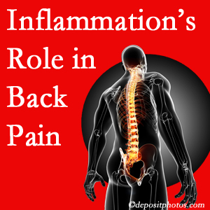 The role of inflammation in Oxford back pain is real. Chiropractic care can manage it.