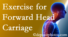 Oxford chiropractic treatment of forward head carriage is two-fold: manipulation and exercise.