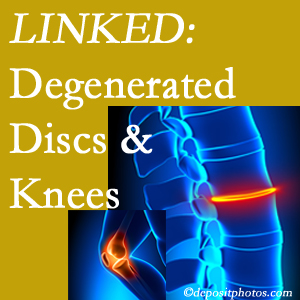 Degenerated discs and degenerated knees are not such unlikely companions. They are seen to be related. Oxford patients with a loss of disc height due to disc degeneration often also have knee pain related to degeneration.  