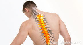 Oxford thoracic spine pain image 