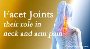 Satterwhite Chiropractic thoroughly examines, diagnoses, and treats cervical spine facet joints for neck pain relief when they are involved.