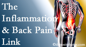 Satterwhite Chiropractic tackles the inflammatory process that accompanies back pain as well as the pain itself.