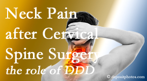 Satterwhite Chiropractic offers gentle care for neck pain after neck surgery.