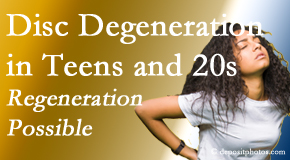 Satterwhite Chiropractic manages back pain due to disc degeneration in younger people in their teens and 20s. 