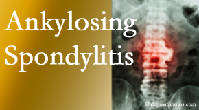 Ankylosing spondylitis is gently cared for by your Oxford chiropractor.