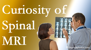Oxford MRIs for spinal stenosis may be revealing…or puzzling.