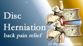 Satterwhite Chiropractic uses non-surgical treatment for relief of disc herniation related back pain. 