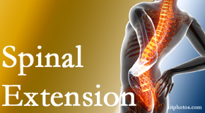 Satterwhite Chiropractic knows the role of extension in spinal motion, its necessity, its benefits and potential harmful effects. 