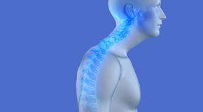 relief of Oxford kyphosis pain