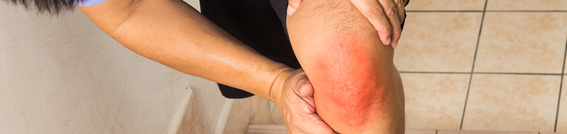 Oxford knee pain, osteoarthritis