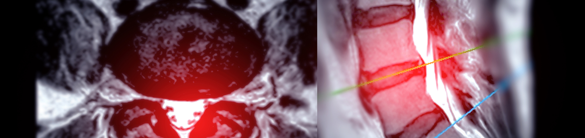 Oxford back pain imaging and exercise