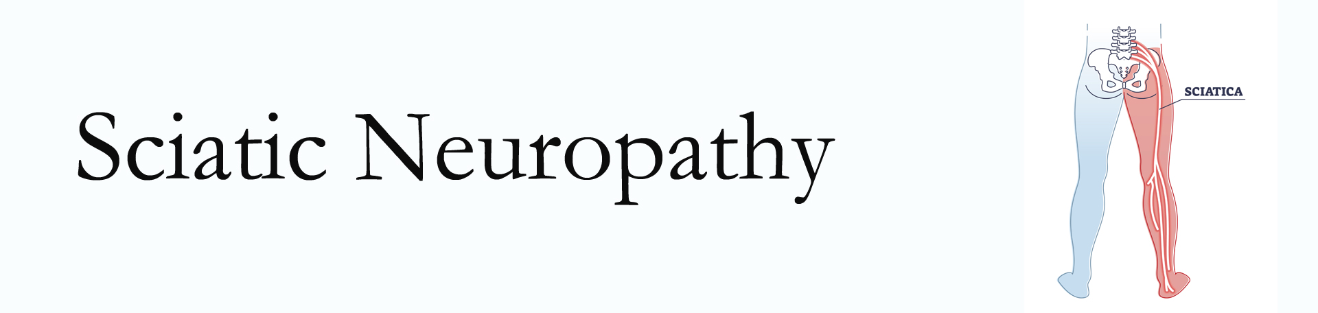 Oxford neuropathy pain (sciatica)