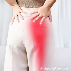 image of Oxford leg pain, sciatica, lumbar radiculopathy