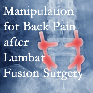 Oxford chiropractic spinal manipulation assists post-surgical continued back pain patients discover relief of their pain despite fusion. 