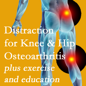 A chiropractic treatment plan for Oxford knee pain and hip pain due to osteoarthritis: education, exercise, distraction.