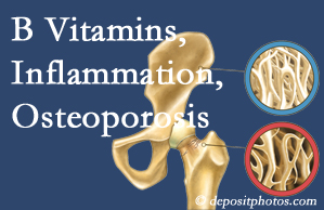 Oxford chiropractic care of osteoporosis usually comes with nutritional tips like b vitamins for inflammation reduction and for prevention.
