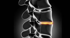 Oxford chiropractic nutrition with vitamin D and quercitrin