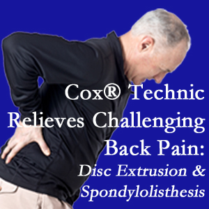 Oxford chiropractic care with Cox Technic alleviates back pain due to a painful combination of a disc extrusion and a spondylolytic spondylolisthesis.