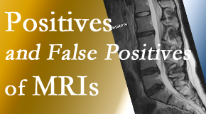 Satterwhite Chiropractic carefully decides when and if MRI images are needed to guide the Oxford chiropractic treatment plan. 