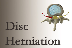 disc-herniation-widget